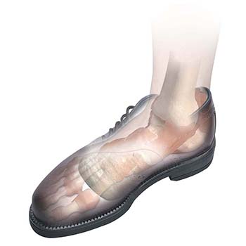 Longitudinal-Metatarsal Arch Pads-2