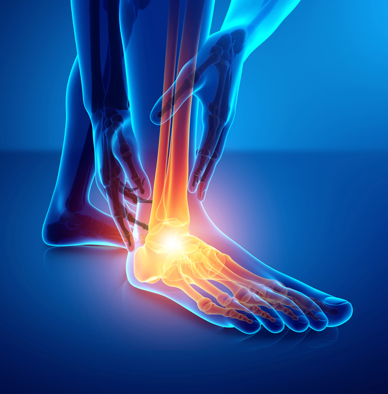 Hapad - Foot Pain Image