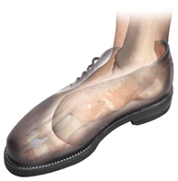 A- Comf-Orthotic 3/4 Length Wool Felt Insoles